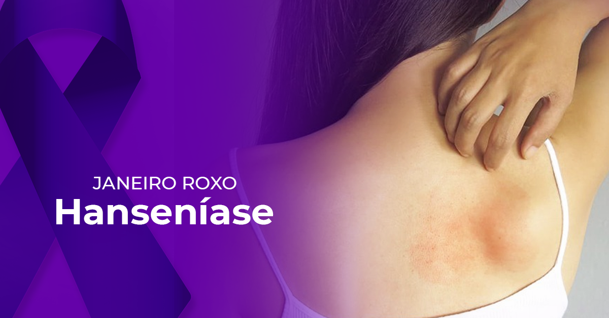 Hanseníase: descubra quais são os seus sintomas!